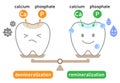 Cute tooth demineralization and remineralization on balance scale. Dental care concept