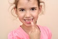 Young girl showing a missing tooth Royalty Free Stock Photo