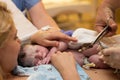 Cutting of the umbilical cord on a newborn baby Royalty Free Stock Photo