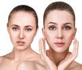 Cwo young women with healthy clear skin. Royalty Free Stock Photo