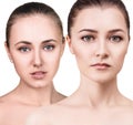 Cwo young women with healthy clear skin. Royalty Free Stock Photo