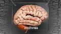 Cyclothymia in human brain