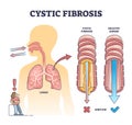 Cystic fibrosis disorder or healthy airflow airway comparison outline diagram