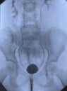Cystography urological xray image
