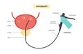 Cystoscopy examination concept