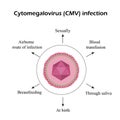 Cytomegalovirus. Diseases caused by cytomegalovirus. Infographics. Vector illustration