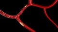 3d clot thrombus for medical health on black