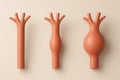 3D comparative render of aortic aneurysm. Three segments: normal aorta, moderate dilation with wall expansion, and severe aneurysm Royalty Free Stock Photo