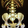 3D ct urological and skeletal systems