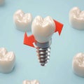 3D dental molar model with red spiral arrow, filling material