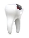 Tooth decay 3D icon transparent illustration