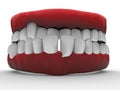 3D illustration - bad teeth Royalty Free Stock Photo