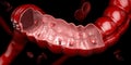 3d illustration of Colon polyps. Polyp in the intestine. isolated black..