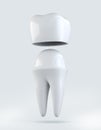 3D illustration of Crown tooth on white background.