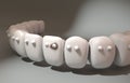 3d illustration. Cute Teeth noticed among themselves the patient