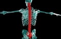 3D illustration of Spine, medical concept