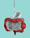 A 3D illustration depicting the large bowel with highlighted spasms, showcasing the characteristic feature of irritable