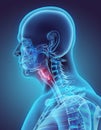 3D illustration of Epiglottis, medical concept. Royalty Free Stock Photo