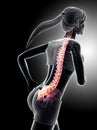 3d illustration - Female run and X-ray Spine position. Royalty Free Stock Photo