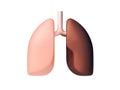 3d illustration of healthy and unhealthy human lungs Royalty Free Stock Photo