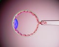 3D illustration of human blastocyst biopsy. PGT-A?Preimplantation genetic testing for aneuploidy)