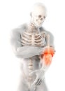 3d illustration of human elbow injury.