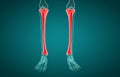 3D illustration of Tibia, medical concept Royalty Free Stock Photo