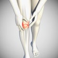 3d illustration of knee pain front view Royalty Free Stock Photo