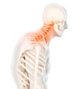 Neck painful - cervical spine skeleton x-ray, 3D illustration.