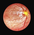 3d illustration of Optical Coherence Tomography OCT