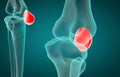 3D illustration of Patella, medical concept Royalty Free Stock Photo