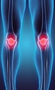 3D illustration of Patella, medical concept. Royalty Free Stock Photo