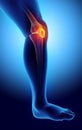 3D illustration of Patella, medical concept. Royalty Free Stock Photo