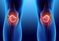 3D illustration of Patella, medical concept. Royalty Free Stock Photo