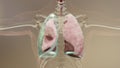 3d Illustration of Pneumothorax, Normal lung versus collapsed