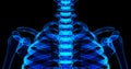 3D illustration of shiny blue skeleton system.