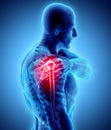 Shoulder painful skeleton x-ray, 3D illustration. Royalty Free Stock Photo