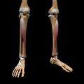 Human tibialis anterior muscles on skeleton Royalty Free Stock Photo