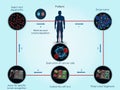 Use of TILs for cancer treatment