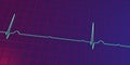 ECG of 3rd degree AV block, 3D illustration