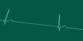 ECG of 3rd degree AV block, 3D illustration