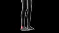 3d illustration of a woman xray hologram showing pain area on the leg area Royalty Free Stock Photo