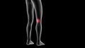 3d illustration of a woman xray hologram showing pain area on the leg area Royalty Free Stock Photo