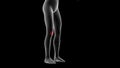3d illustration of a woman xray hologram showing pain area on the leg area Royalty Free Stock Photo