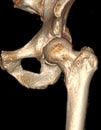 3D CT Volume Rendering HIP