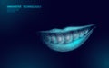 3D invisible orthodontic braces. Wonam smile tooth trainer. Dental theatment heath care medical banner. Low poly design Royalty Free Stock Photo