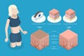3D Isometric Flat Vector Conceptual Illustration of Albinism Royalty Free Stock Photo