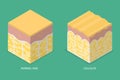 3D Isometric Flat Vector Conceptual Illustration of Cellulite Skin Royalty Free Stock Photo