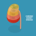 3D Isometric Flat Vector Conceptual Illustration of Chronic Kidney Disease