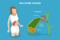 3D Isometric Flat Vector Conceptual Illustration of Gallstone Disease